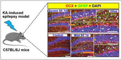 New Insights Into the Role of Aberrant Hippocampal Neurogenesis in Epilepsy